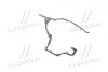 Прокладка Case передней крышки двигателя MGM310 CNH J944293 (фото 4)